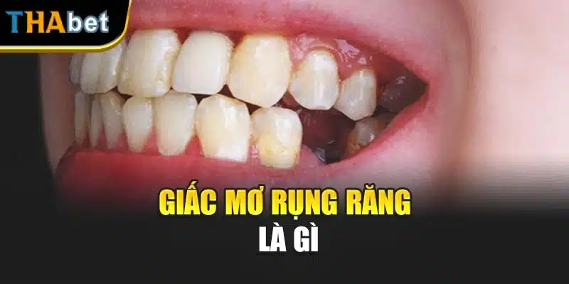 Giấc mơ rụng răng là gì